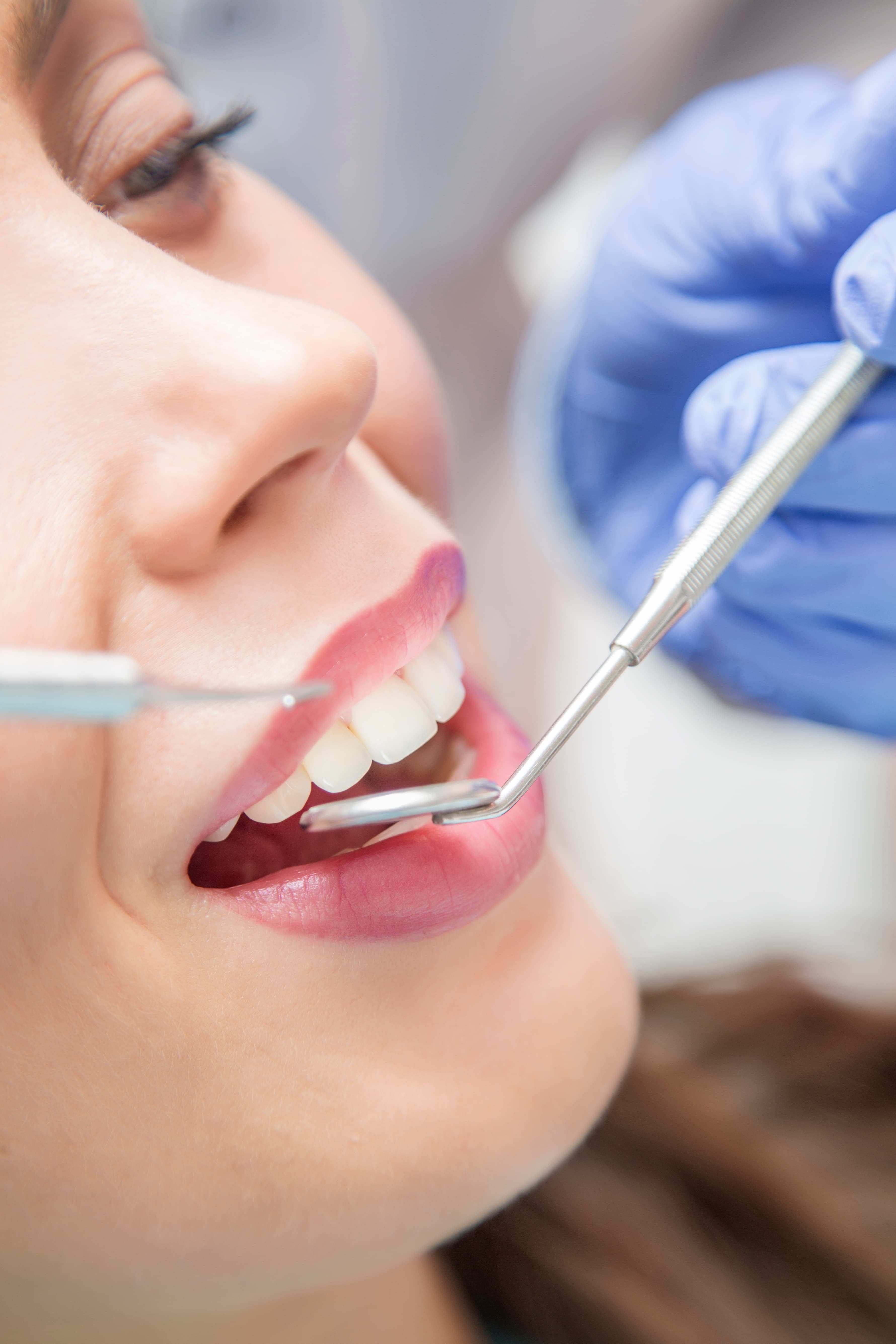 Paciente sonriendo durante una revisión dental